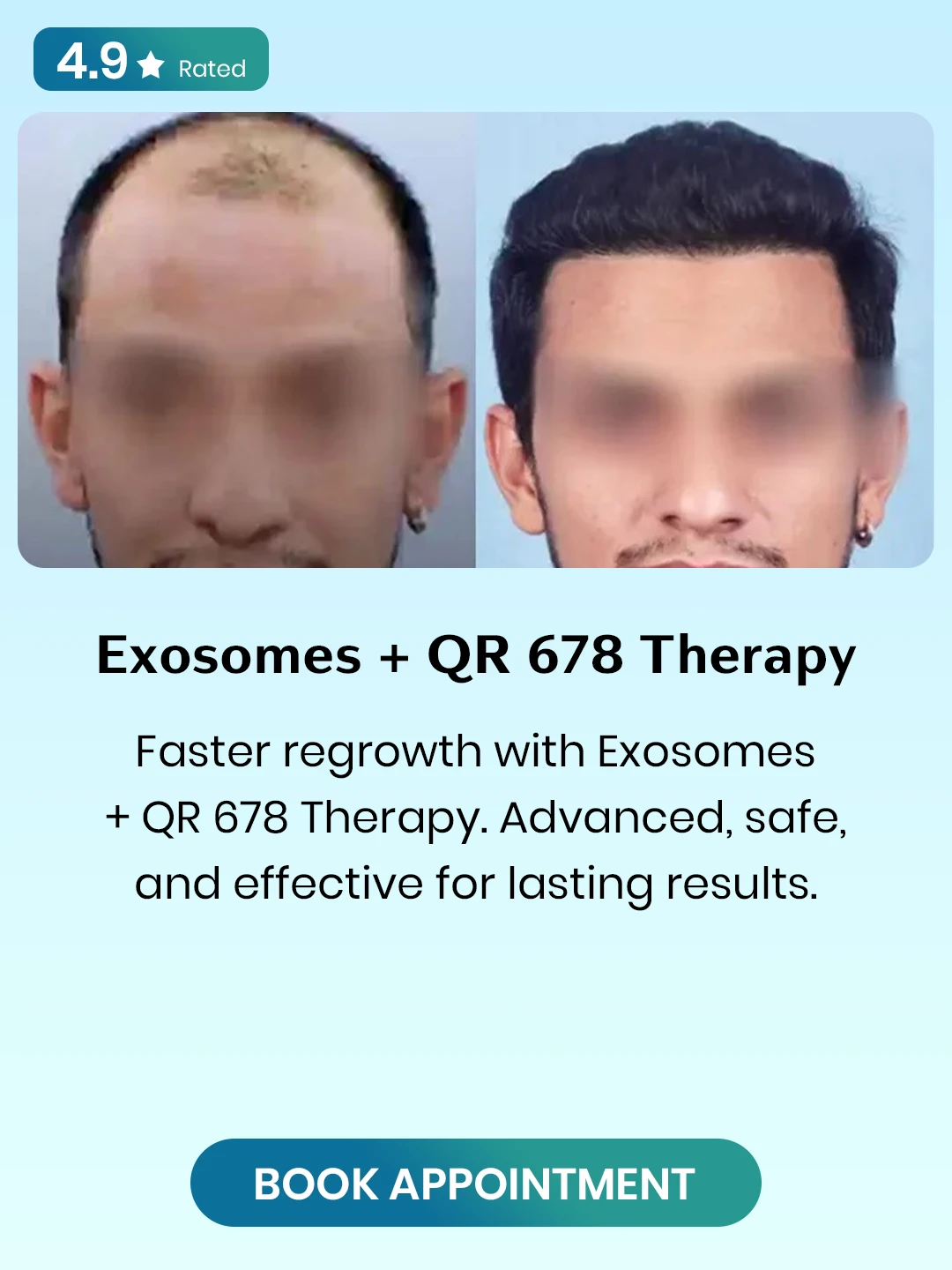 Exosomes-QR-678-Therapy.webp