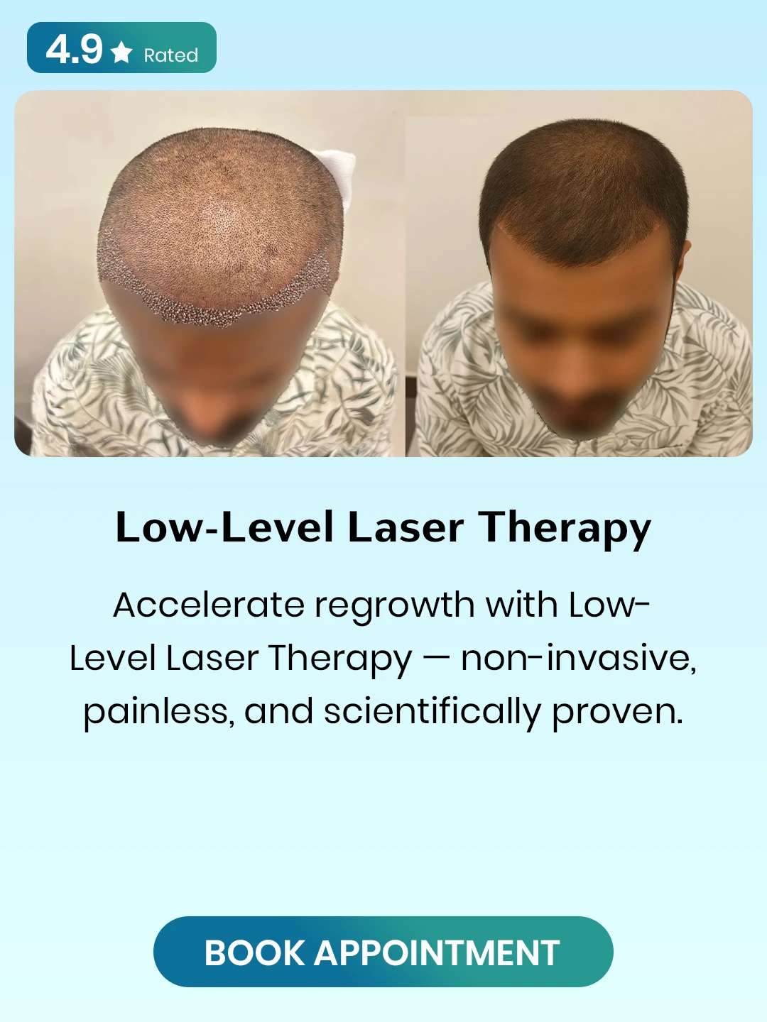 Low-Level-Laser-Therapy.webp