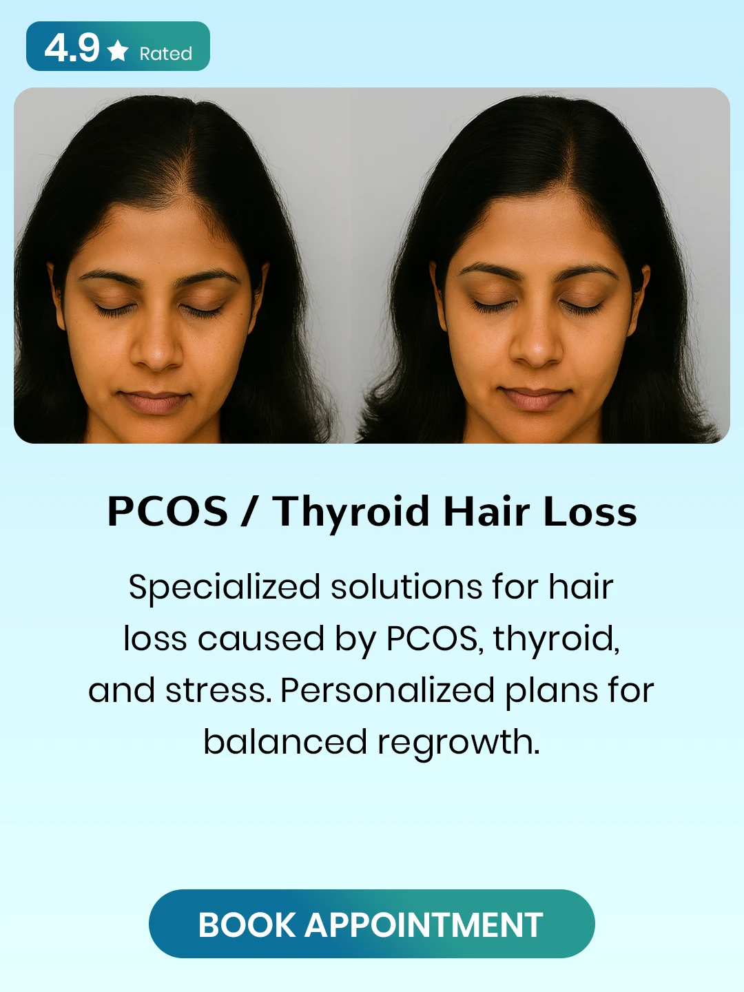 PCOS-_-Thyroid-Hair-Loss.webp