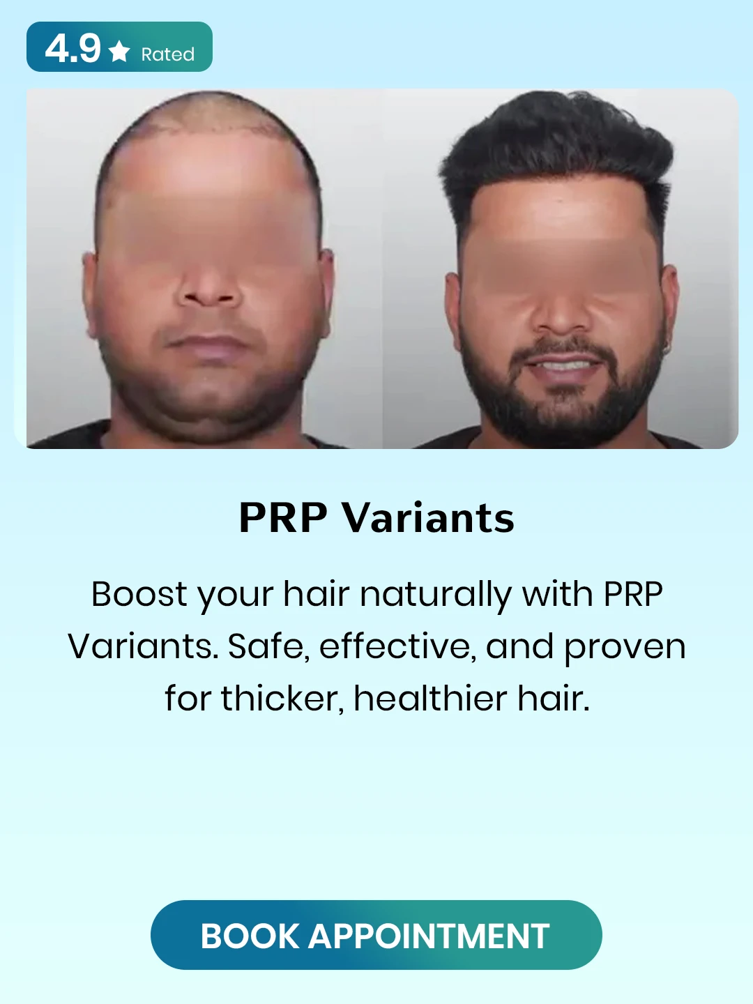 PRP-Variants-1.webp