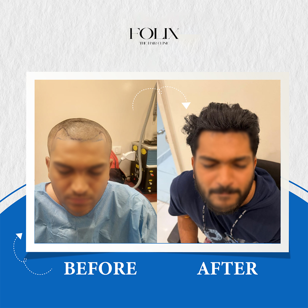 folix hair 1 copy 17