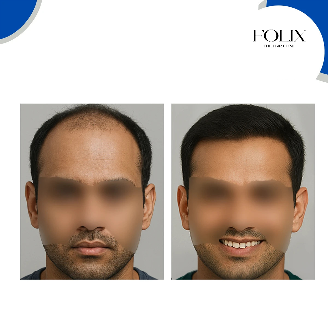 folix hair 1 copy 8
